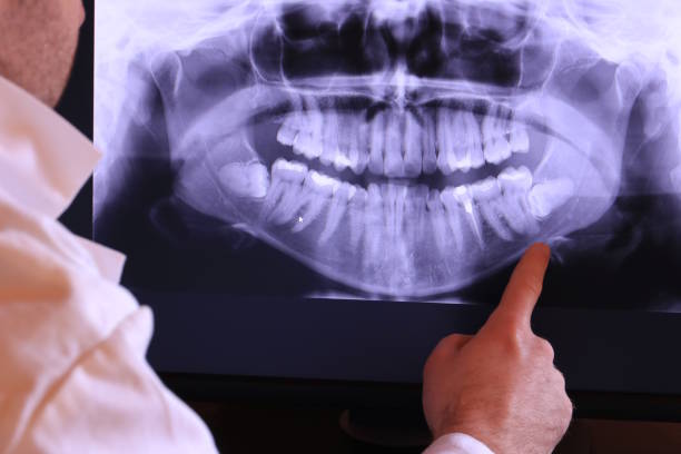 Best Emergency Treatment for Jaw Pain or Injury in Junction City, OR